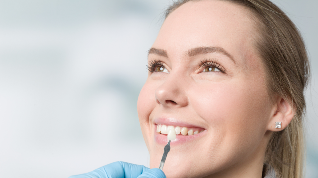 3 Incredible Benefits of Dental Veneers from Village Green Dentistry in Lincolnshire, Ilinois